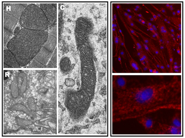 Left. Electron microscopy of heart (H), retinal pigment epithelium (R) and cerebellum Purkinje layer (C) with mitochondria as double membrane organelles.  Right. Fluorescence microscopy of cultured cardiomyocytes stained for nuclei (blue) and mitochondria (red).