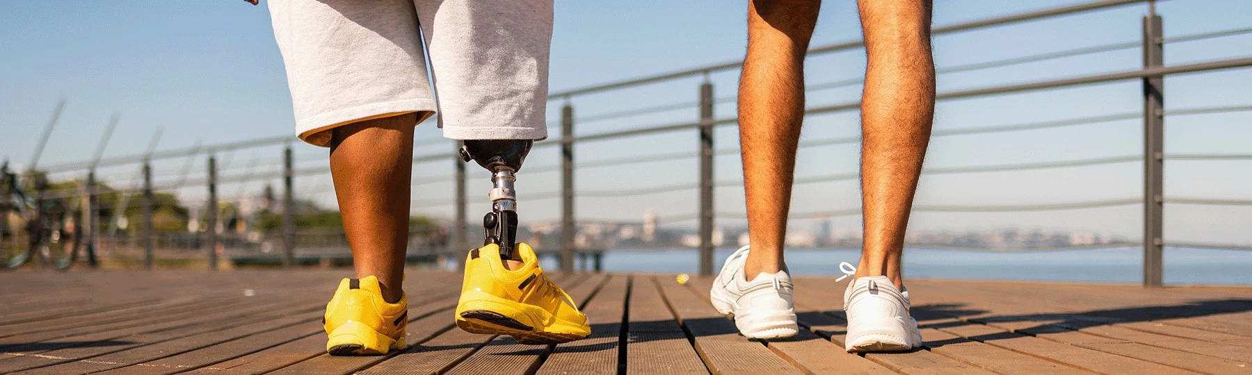 Image of two individual's legs, one with a prosthetic leg.