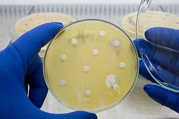 Two gloved hands hold an open petri dish full of growing medium and bacterial colonies.